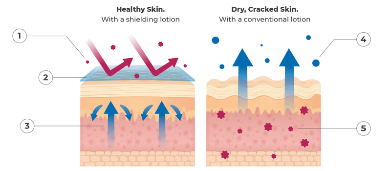 shielding lotion for dry skin